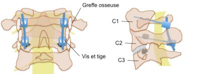 Cliquer pour agrandir.