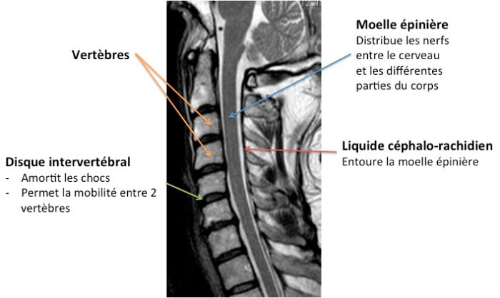 Schema Rachis Anatomie du rachis cervical